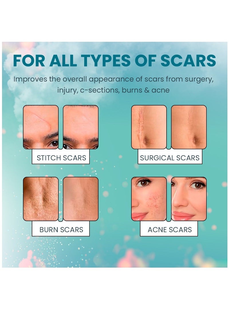 Elaimei جل إزالة الندبات 50 مل جل الندبات المتقدم ينعم ويسطح الندبات الناتجة عن إصابات العمليات الجراحية والحروق علاج طبيعي للندبات للوجه والجسم - Image 4